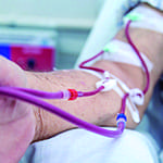 Fistulas arteriovenosas para hemodiálisis