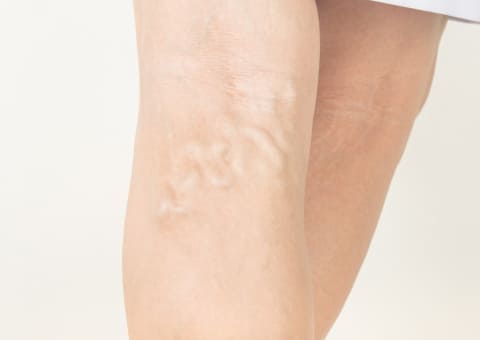 Angiólogo y Cirujano Vascular