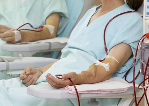 Fistulas arteriovenosas para hemodiálisis 