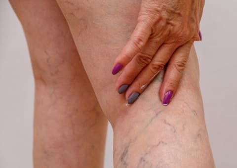 Médico cirujano vascular en CDMX