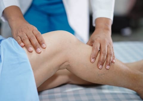 Médicos angiólogos en DF